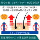 フィナライズ1mgの効果