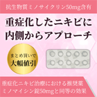 ミノロックス50mgの特徴