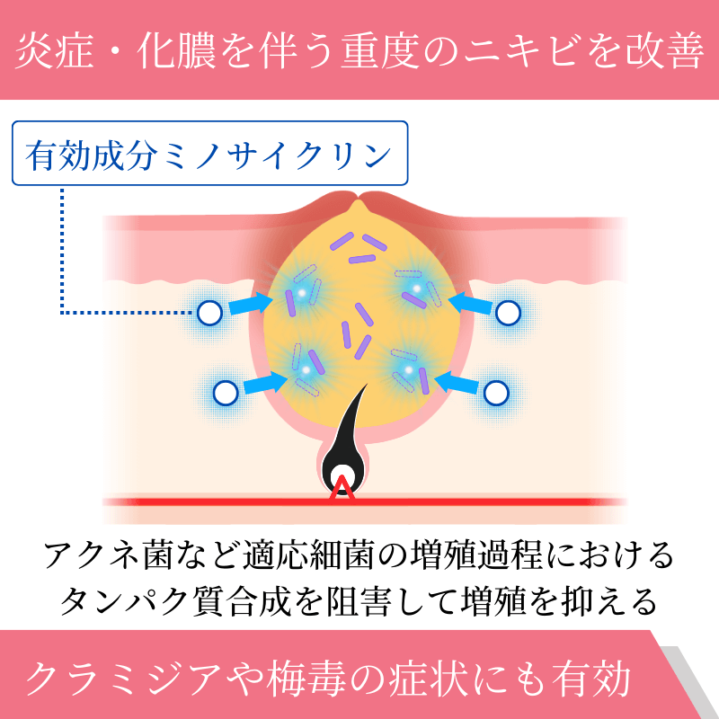 ミノロックス50mgの効果