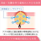 ミノロックス50mgの効果