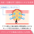 ミノロックス100mgの効果