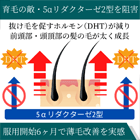 プロペシア1mgの効果