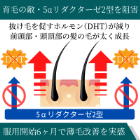 フィンペシア1mg(150錠)の効果・効能
