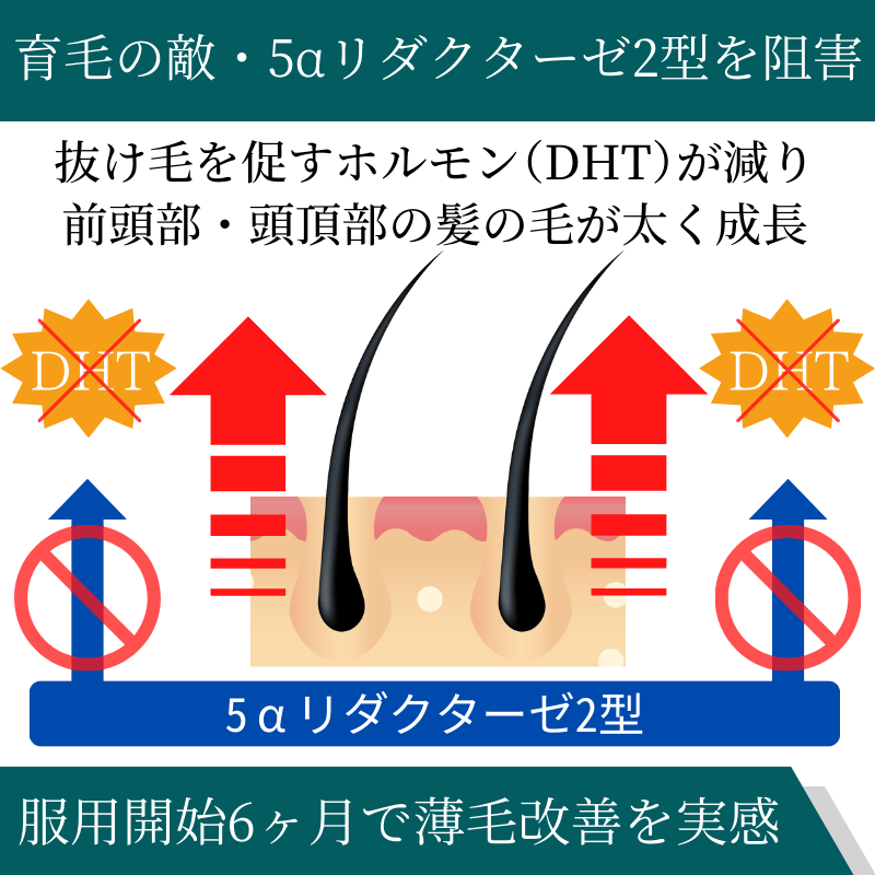 エフペシア1mgの効果
