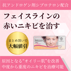 ダイアン35の特徴