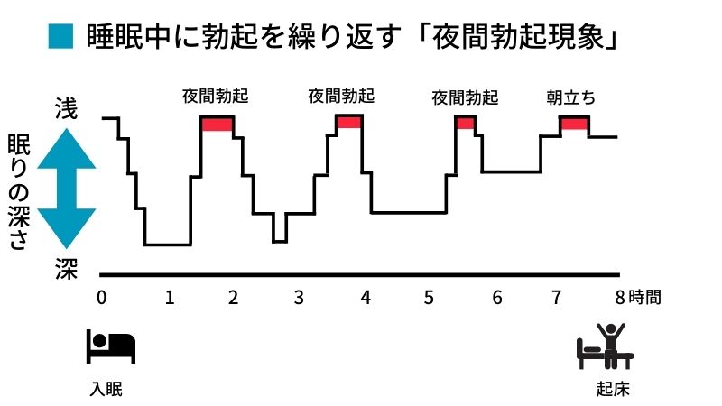 睡眠中に勃起を繰り返す「夜間勃起現象」