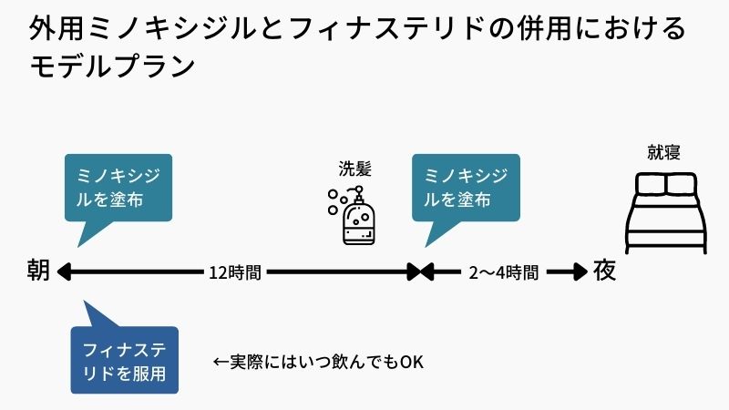 外用ミノキシジルとフィナステリドを併用する場合のモデルプラン