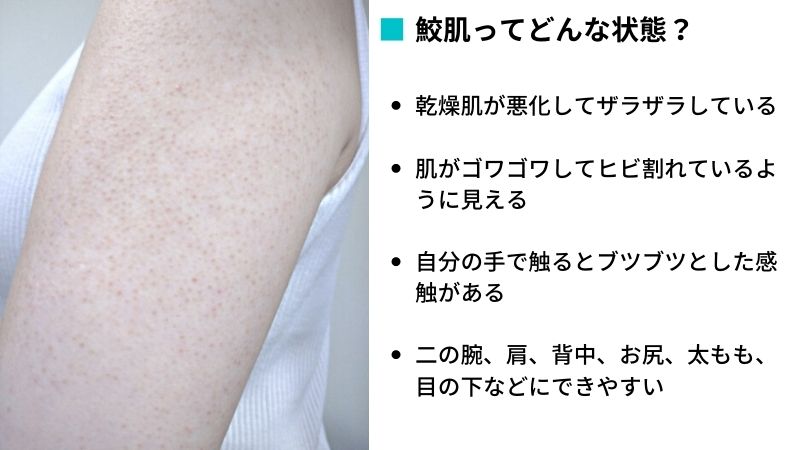 鮫肌の画像