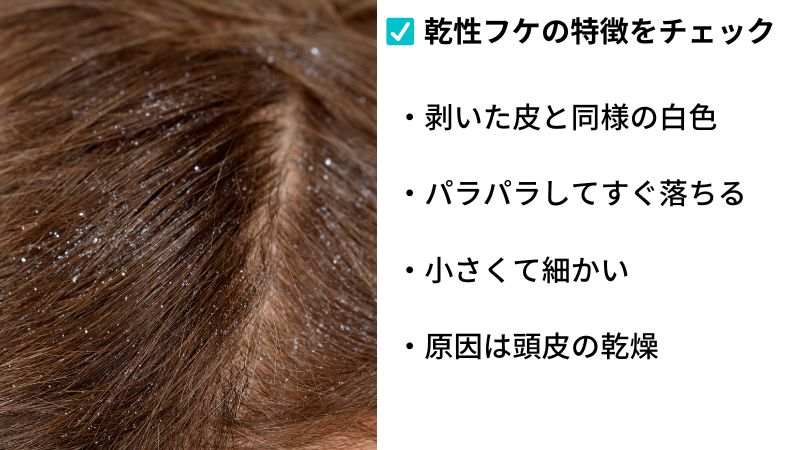 乾性フケの特徴