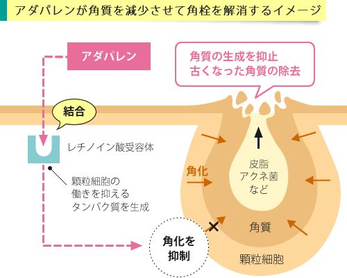 アダパレンが作用するイメージ