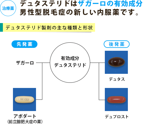 ザガーロ、アボダート、デュタスなどデュタステリド製剤の主な種類