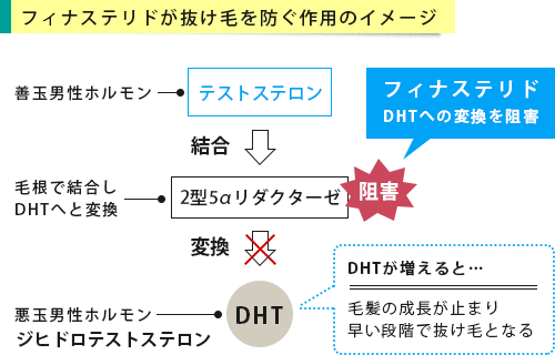 フィナステリドが作用するイメージ