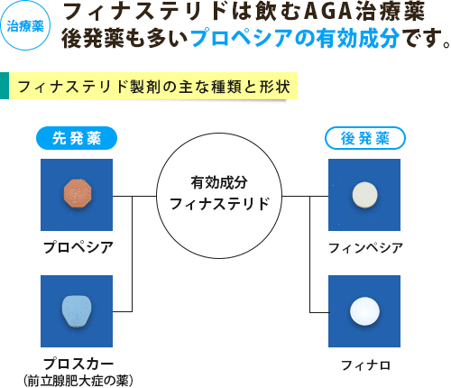 プロペシア、プロスカー、フィンペシアなどフィナステリド製剤の主な種類