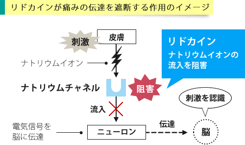 リドカインが作用するイメージ