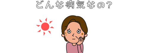 老人性色素班とは？