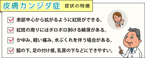紅斑、できやすい部位など皮膚カンジダ症の症状チェックリスト