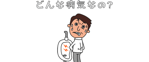 淋菌感染症(淋病)とは?