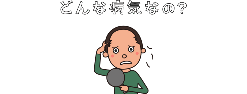 男性型脱毛症（AGA）とは？