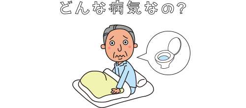 前立腺肥大症とは？