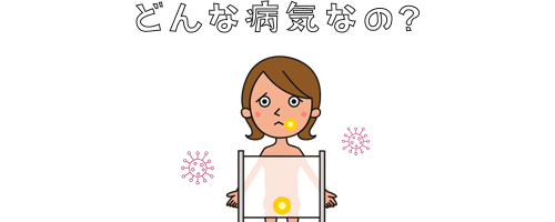 単純ヘルペスウイルス感染症とは？
