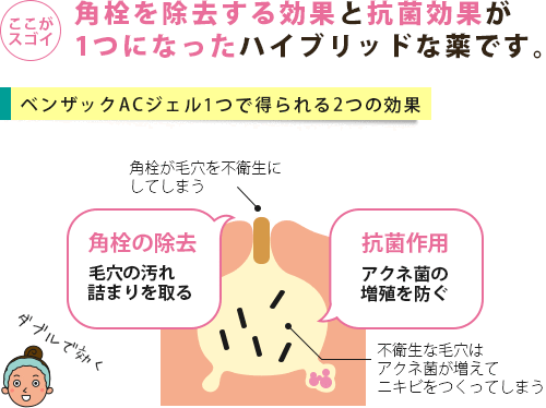 毛穴に詰まった角栓の除去とアクネ菌を増やさない抗菌の2つの効果