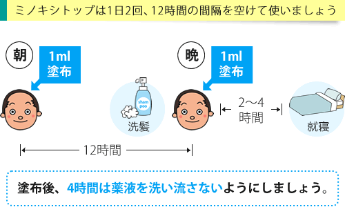 ミノキシトップの使い方は毎日朝晩2回