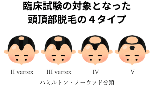 国内第II／III相二重盲検比較試験の被験者・ハミルトン・ノーウッド分類による軽度～中等度のAGA患者